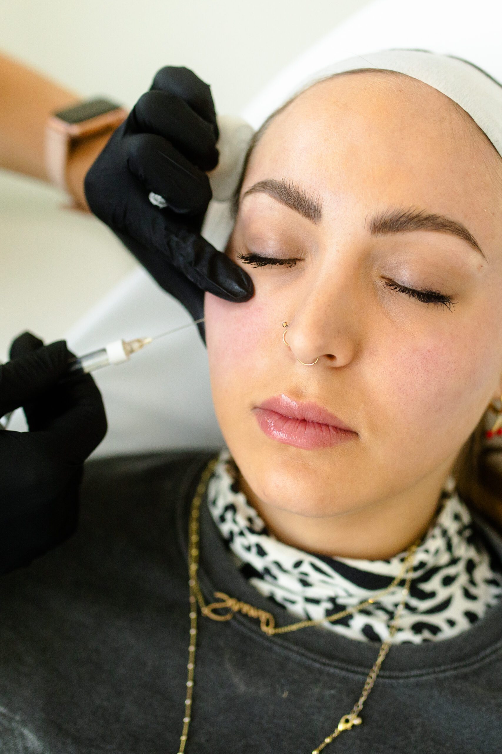 Dermal Filler Denver Boulder CO