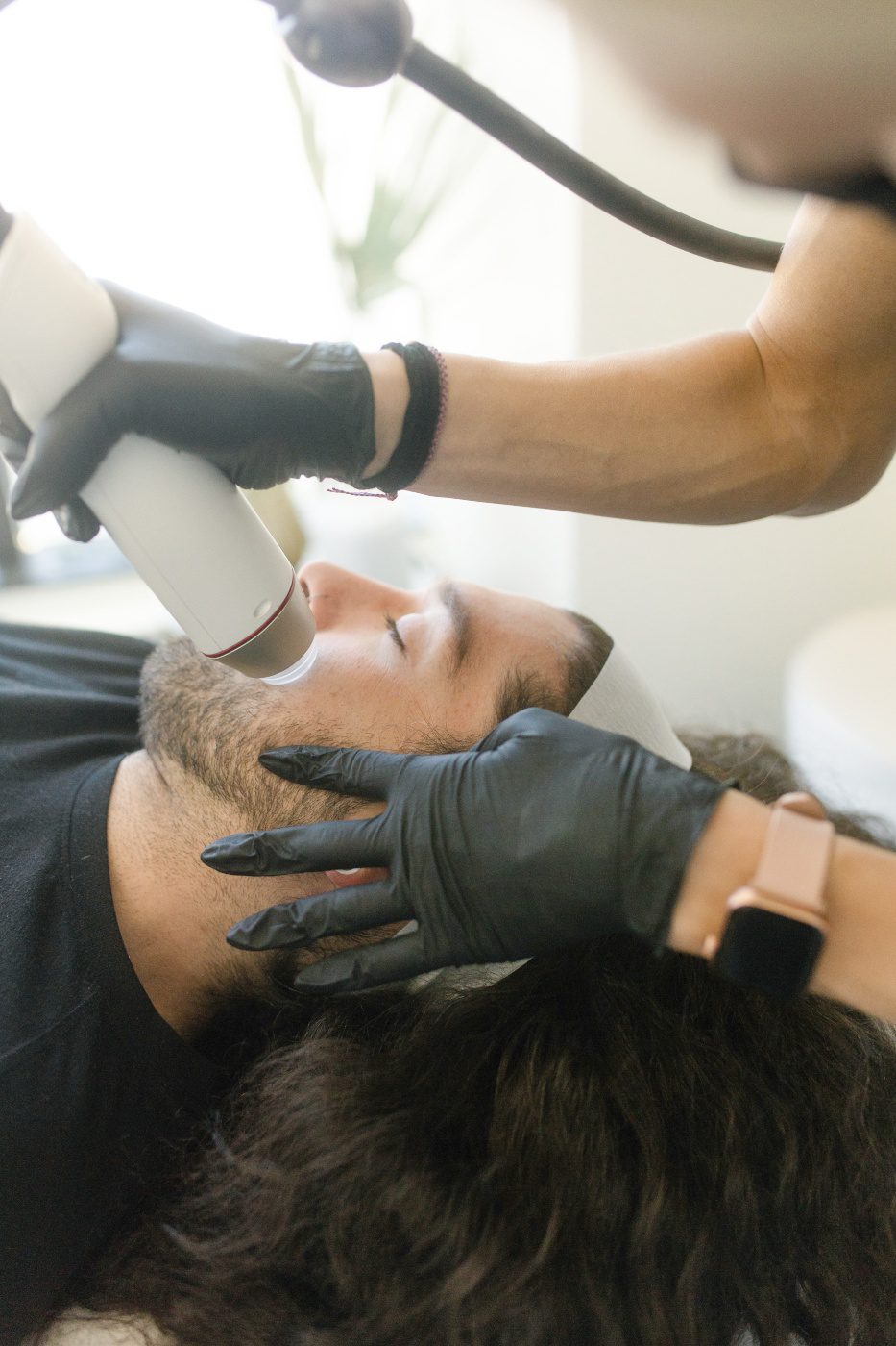 best-rf-microneedling-denver-boulder