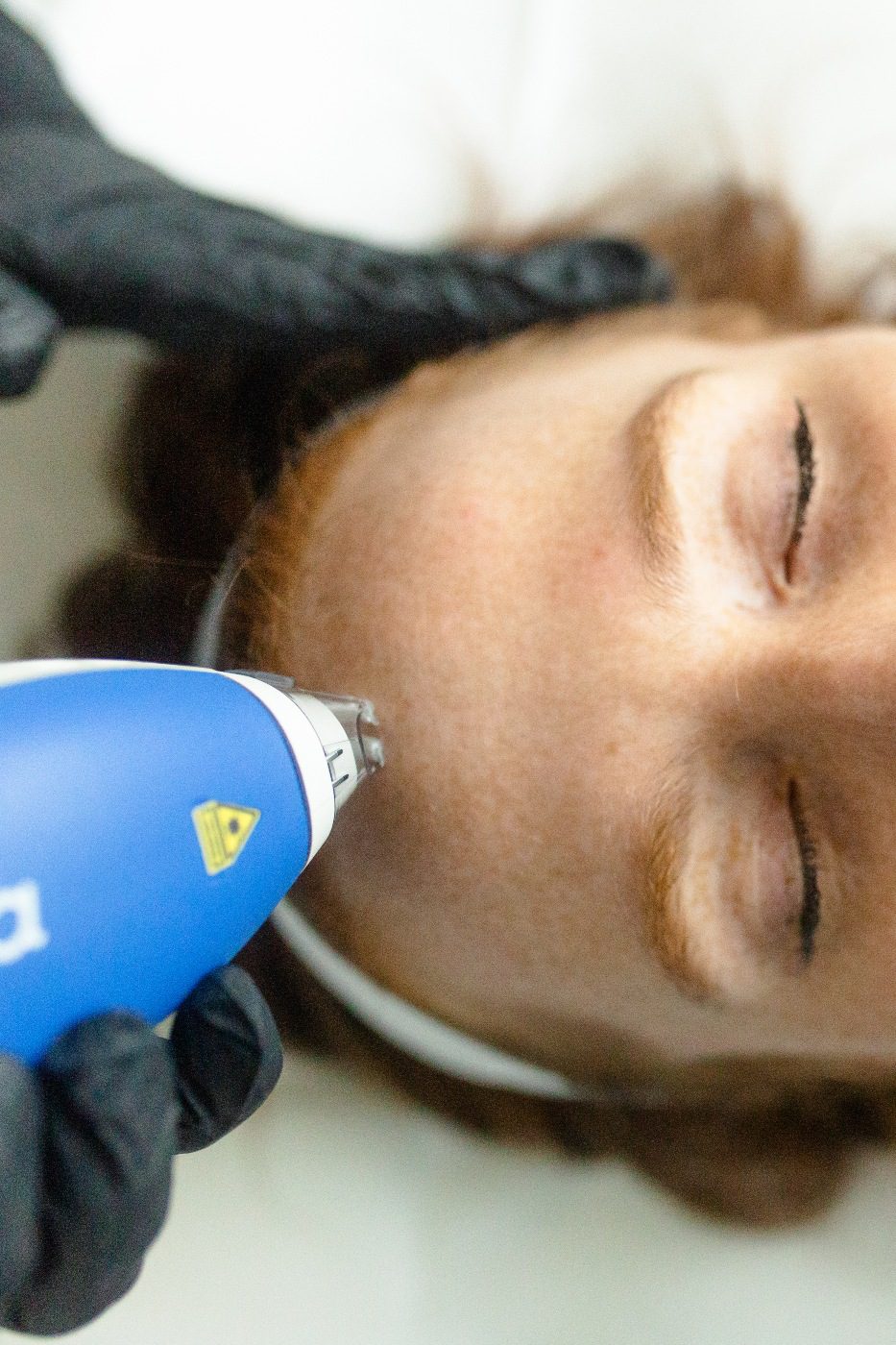 clear-and-brilliant-laser-denver-boulder